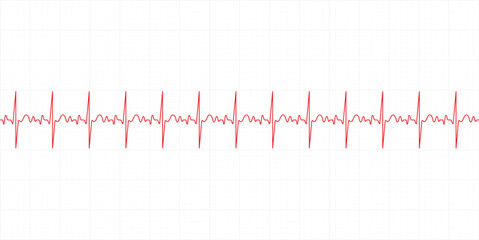 Electrocardiography heartbeat line monitor. Ecg