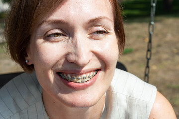 woman 30-35 years old, wearing braces, smiling, close-up, positi