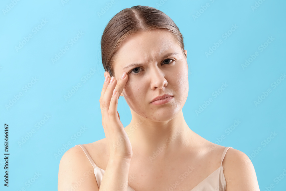 Upset teenage girl with acne problem on blue background, closeup