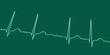 ECG in atrial fibrillation, 3D illustration