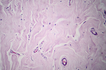 Poster - Ffibroadenoma, light micrograph