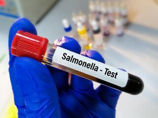 Wall Mural - Blood sample for Salmonella bacteria test, Typhoid fever test