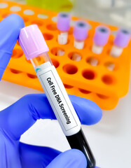 Poster - Blood sample for Prenatal Cell Free DNA Screening test during pregnancy, to diagnose Down syndrome.