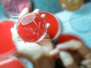 Canvas Print - Technician check bacterial colony for the identification of organisms.