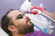 © Westend61 - Man with beard getting laser removal treatment at clinic
