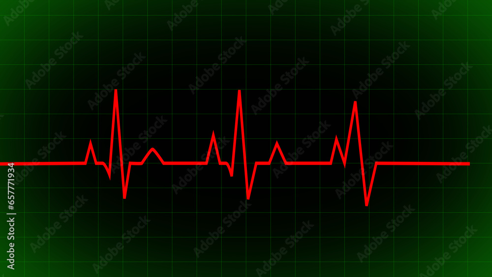 heartbeat line icon. Pulse line, Pulse trace. ECG and Cardiac symbol. Emergency ecg monitoring. glowing neon heart pulse. Heart beat. Electrocardiogram. Health and Medical concept.