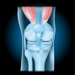 Poster - Knee joint with Quadriceps