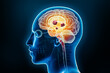 © Matthieu - Cancer brain with cancerous cells or tumors x-ray 3D rendering illustration with body. Anatomy, neurological disease, oncology, medical, psychology, science, neuroscience, neurology concepts.