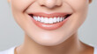 © PRASANNAPIX - Close view of female face happy smile with white teeth