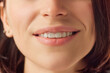 © Lustre Art Group  - Close up cropped photo of young smiling with teeth female face, lips without lipstick. Natural gloss of lips and woman's skin. Increase in lips, cosmetology.