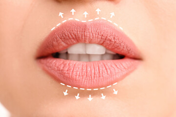 Sticker - Beautiful young woman with pink lips, closeup