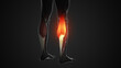 Pain and injury in the Gastrocnemius Muscles