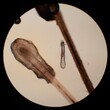 Demodex folliculorum - parasitic mite on the eyelashes of a human eye
