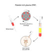 Platelet-rich plasma (prp). Autologous conditioned plasma, is a concentrate of PRP extracted from whole blood. After centrifugation, extract PRP and inject knee. Vector Illustration
