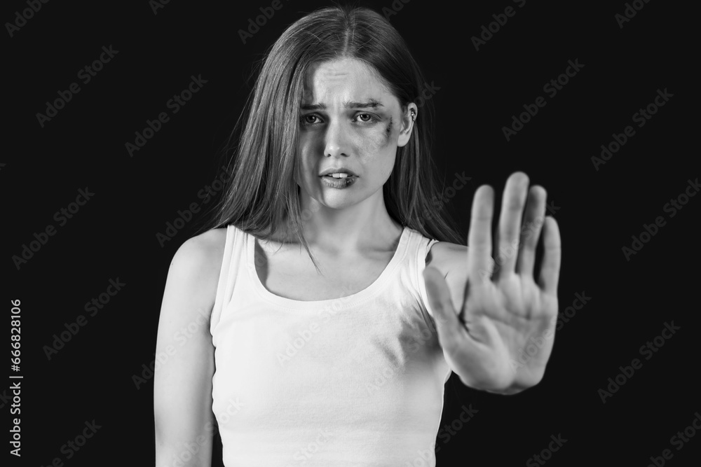Bruised young woman showing stop gesture on dark background. Domestic violence concept