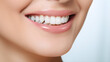 © Taisiia - Beautiful smile girl with white teeth