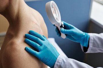 Wall Mural - Side view closeup of doctor using magnifying glass and examining back of male patient in dermatology clinic