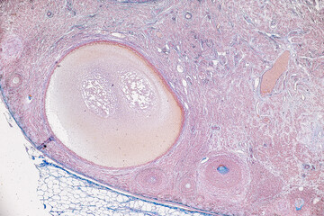 Backgrounds of Characteristics Tissue of Ovary rabbit and Tissue of Testis mouse under microscope.