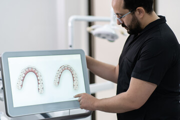 Aufkleber - Skilled dentist showing lower and upper human jaws models on monitor presenting teeth treatment program at stomatology industry development conference
