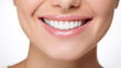 © jcalvera - Close-up of healthy white teeth of a smiling woman. Dental care concepts