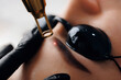 © Parilov - Laser removal of tattoo permanent makeup eyebrow of young woman in salon