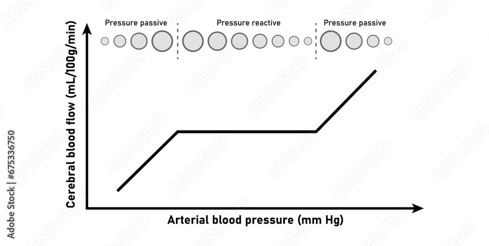 Cerebral autoregulation monitoring curve. Traumatic brain injury ...