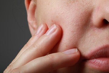 Poster - Closeup view of woman with healthy skin on grey background