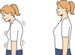 Stooped woman before and after correcting posture thanks to massage therapist or chiropractor