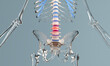 Compression fracture in the lumbar spine with glass skeleton