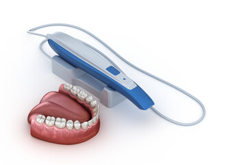 Wall Mural - Intraoral Teeth 3D scanner. My own design. Dental 3D illustration concept