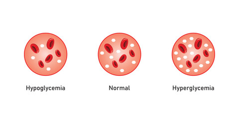 Wall Mural - Blood glucose Level Scientific Design. Vector Illustration.