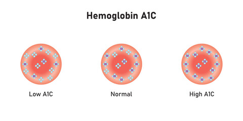 Wall Mural - Hemoglobin A1c  Levels Scientific Design. Vector Illustration.