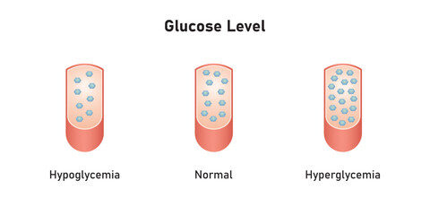 Wall Mural - Blood glucose Level Scientific Design. Vector Illustration.