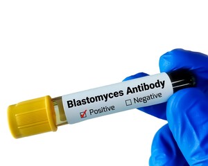 Sticker - Blastomycosis is an infection caused by a fungus called Blastomyces. Blastomytes Antibody test