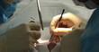 Dental treatment close-up. A dentist performs a dental procedure. Dentist's hands at work. Oral cavity in the process of treatment at the dentist.