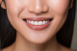 © Sawai Thong - Healthy smile teeth of young woman.