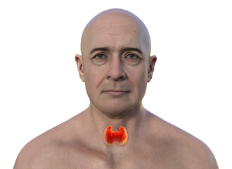 Poster - A man with a normal thyroid gland, 3D illustration