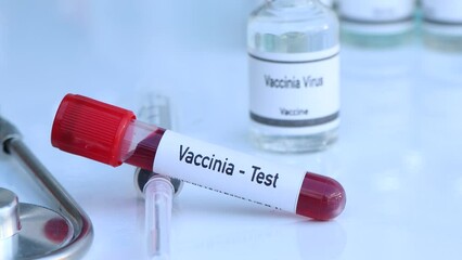 Poster - Vaccinia test to look for abnormalities from blood, scientific experiment