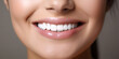 © Nedrofly - A Captivating Smile Revealing Impeccable Dental Health and Professional Care