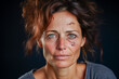 Mujer de edad mediana con expresión triste y angustiada, víctima del maltrato machista, con heridas en la cara