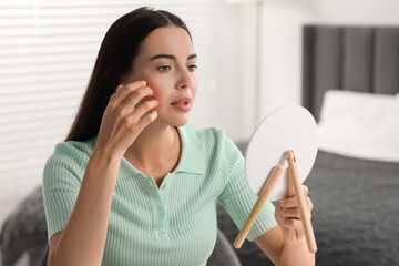 Poster - Suffering from allergy. Young woman looking in mirror and scratching her face in bedroom