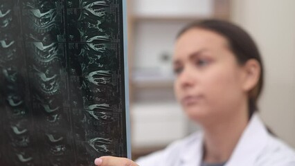 Poster - close up orthopedic doctor evaluates patient X-ray films and MRI scans looks worried 