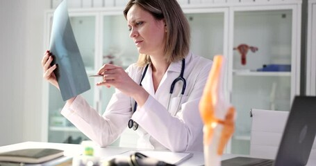 Canvas Print - The woman shows the doctor looks at the X-ray, close-up. Diagnosis of bone fracture, traumatologist