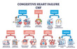 Key aspects of congestive heart failure or CHF explanation outline diagram. Labeled educational scheme with stroke prevention, treatment and diagnostics vector illustration. Cardiovascular disease.