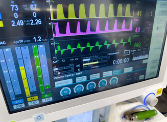  hospital monitor displaying vital signs and hemodynamics, illustrating healthcare and patient monitoring