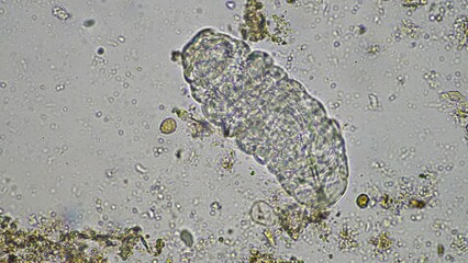 Sticker - Soil under the microscopy, looking at sand, silt and clay and soil biology, amoebae, fungi, fungal, microbes and nematodes in a cattle farm in australia. 
