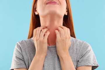 Wall Mural - Suffering from allergy. Young woman scratching her neck on light blue background, closeup