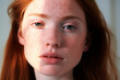 Teenage Ginger Hair Girl Portrait With Beautiful teenager skin with freckle, Sun on her face