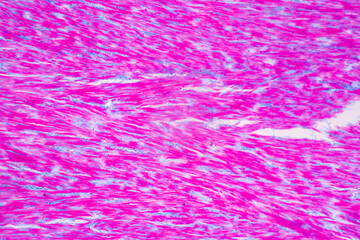 Poster - Anatomy and Histological Rea Bone marrow Human, Hyaline cartilage human and Tendon human under the microscope for education.