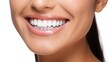 © morepiixel - Closeup woman smiling with clean teeth. used for a dental ad.